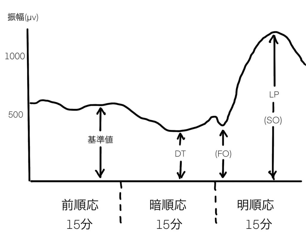 網膜電図検査の後はどうなりますか?